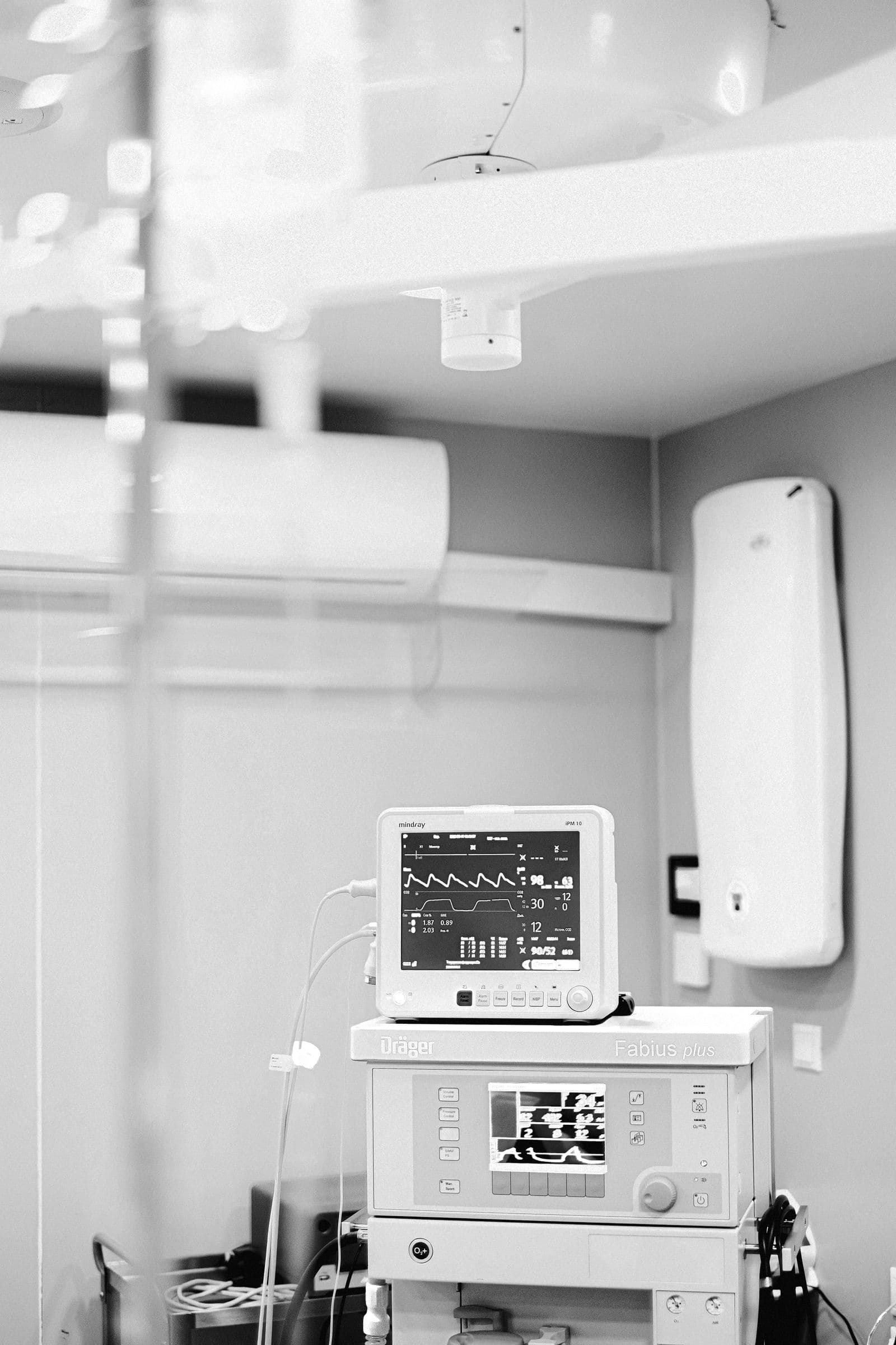 A bedside monitor displaying an ECG waveform and heart rate readings