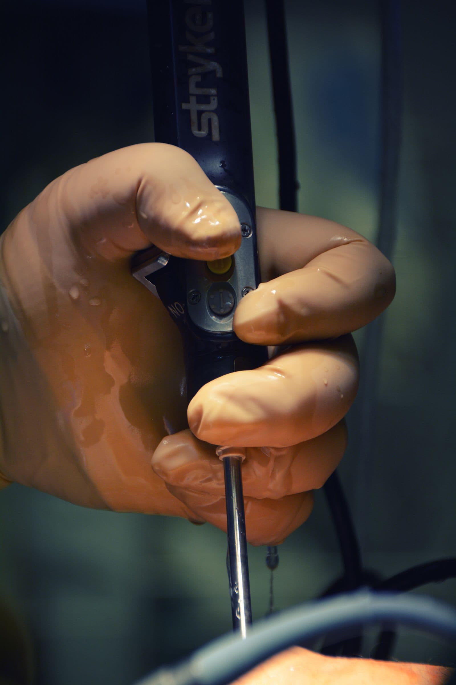 A gloved hand operating a surgical instrument during a procedure