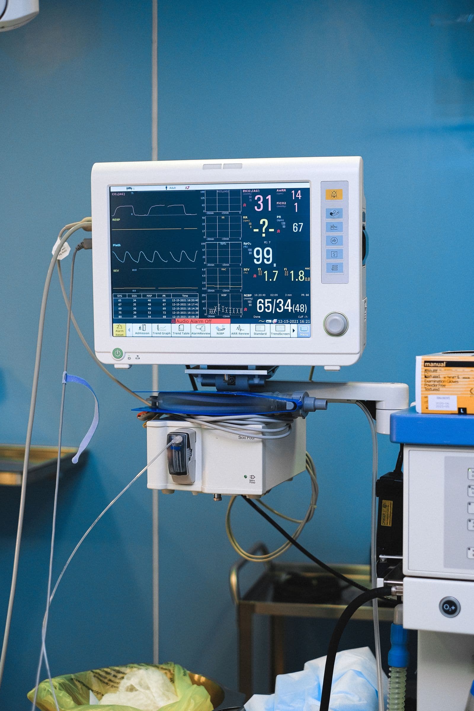 A hospital monitor displaying continuous vital signs and heart rate data