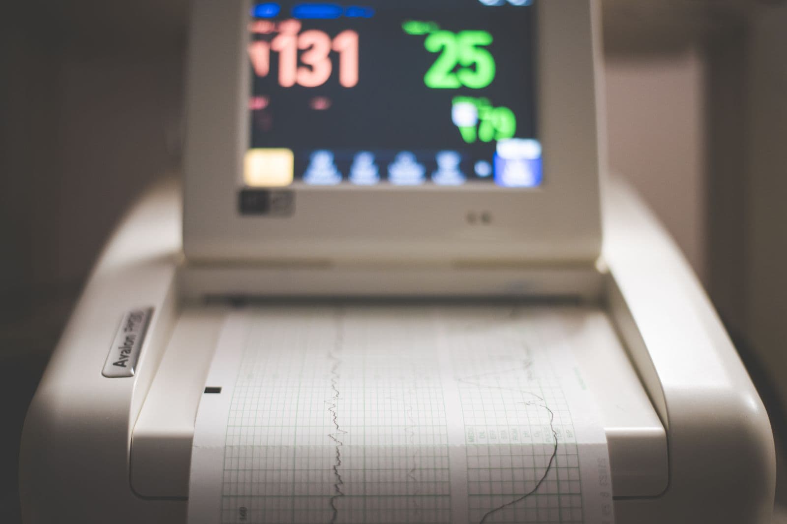 A CTG monitor printing a fetal heart rate and contraction trace